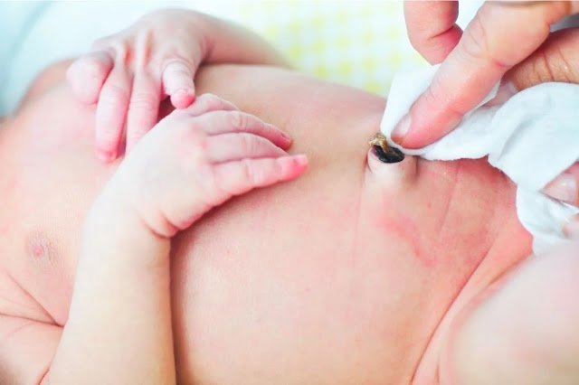 Bebeklerde Göbek Fitiği Bebeklerde Göbek Fitiği