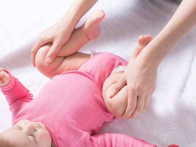 Bebeklerde Kalça Çıkığı Nasıl Anlaşılır? Bebeklerde Kalça Çıkığı