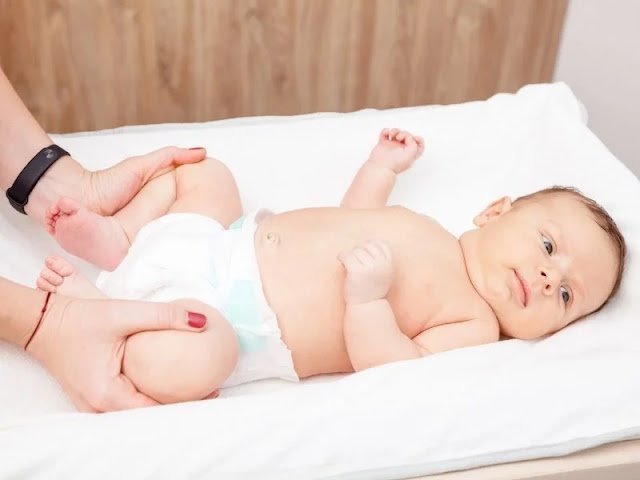 Bebeklerde Kalça Çıkığı nedir Bebeklerde Kalça Çıkığı nedir