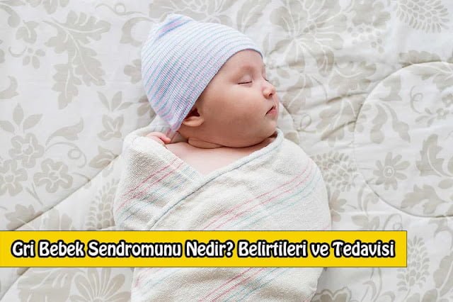 Gri Bebek Sendromu Nedir? Belirtileri ve Tedavisi Gri Bebek Sendromunu