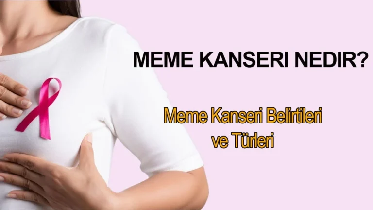 Meme Kanseri
