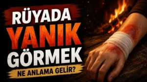 Rüyada yanık görmek ne anlama gelir başlıklı kapak görselinde, ateşli bir arka plan önünde eli bandajlı ve yanık izi bulunan bir kişi ile büyük tipografik başlık yer alıyor.