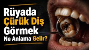 Rüyada Çürük Diş Görmek Ne Anlama Gelir?