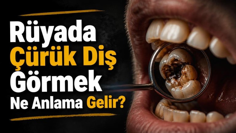 Rüyada Çürük Diş Görmek Ne Anlama Gelir?